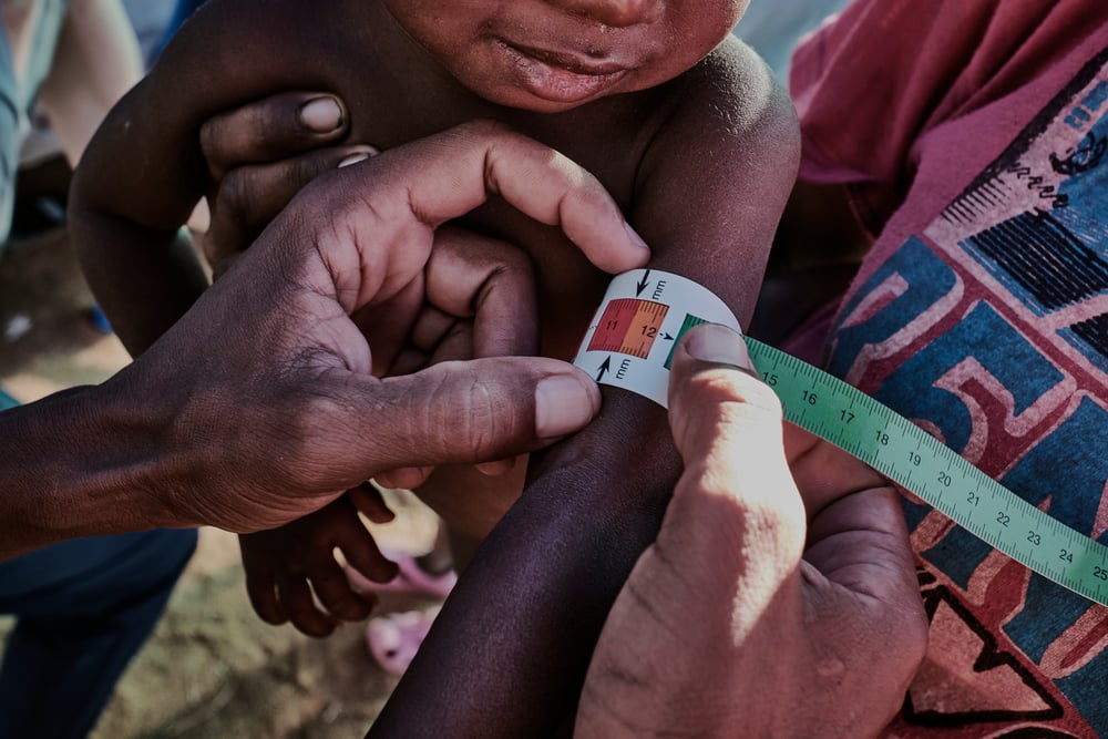 El MUAC (siglas en inglés de middle-upper arm circumference) es una forma rápida de identificar a los niños y niñas en riesgo de desnutrición. El medidor proporciona un número e indica la gama de colores. Madagascar, abril de 2021
