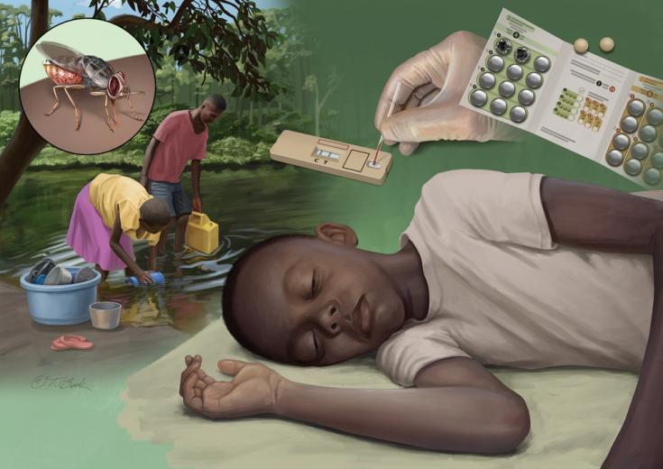 Enfermedad del sueño Enfermedad del sueño