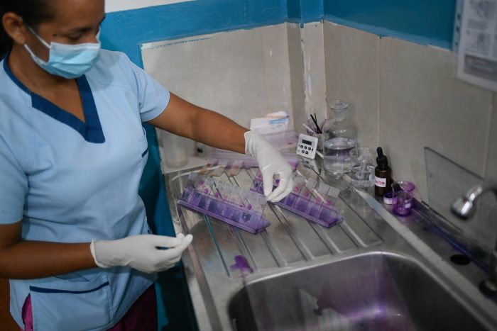 Imagen de archivo del 11 de mayo de 2021: la microscopista Luzbelys Rivas sostiene pruebas realizadas a personas con síntomas de malaria en la comunidad rural de San Vicente del estado Sucre, al noreste de Venezuela, para analizar sus resultados.Matias Delacroix.