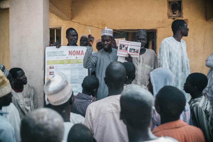 Equipo de extensión de MSF, Hospital Sokoto Noma