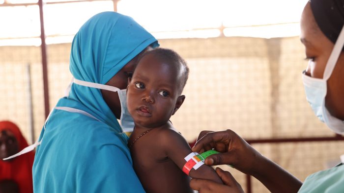 Ibrahim Sheriff sufre desnutrición aguda y fue llevado al centro de nutrición Nilefa Kiji de Maiduguri (Nigeria) para ser inscripto en nuestro programa de alimentación ambulatoriaAbdulkareem Yakubu.