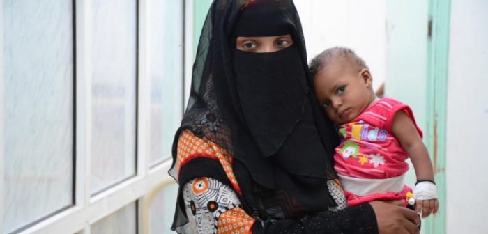 Una madre sosteniendo a su hija en el Centro de Tratamiento de cólera apoyado por MSF en el hospital Al-Sadaqa, Junio 2017. La niña tuvo cólera y sufrió diarrea aguda.Malak Shaher/MSF