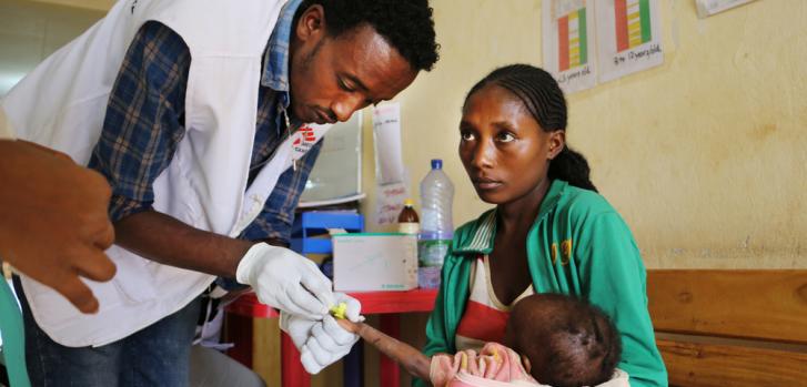 Un miembro de Médicos Sin Fronteras (MSF) atendiendo a un niño con desnutrición en el centro de estabilización en el hospital de Gedeb, en Gedeo, al sur de Etiopía. 
Markus Boening/MSF