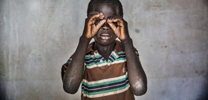 Issa, de 10 años, fue secuestrado por un grupo armado cuando su aldea fue atacada. Pasó varios meses en cautiverio y vio cuando mataban a otro niño.Juan Carlos Tomasi/MSF