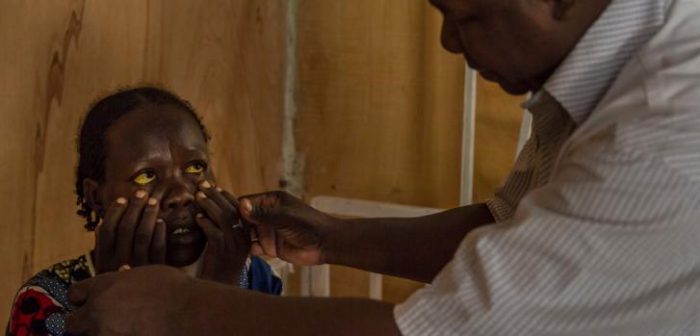 El Dr. Roamba hace sus rondas de chequeo en el Centro de Salud de Madres y Niños (CSME) en Diffa, Níger, con pacientes que sufren de hepatitis E. ©Guillem Valle/MSF