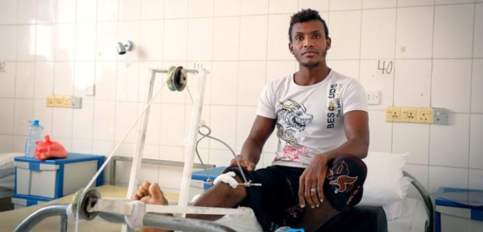 Un paciente en el hospital de MSF en Aden, Noviembre de 2017. MSF está recibiendo heridos de las líneas del frente en su hospital en Aden.Ehab Zawati/MSF