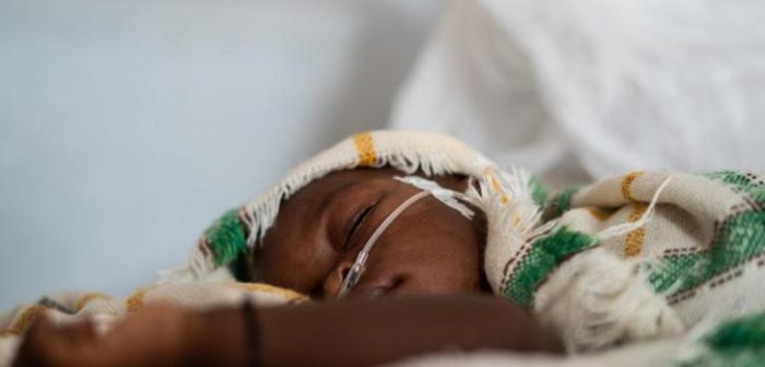 Esta imagen no pertenece a la niña que aparece en el artículo. Es una foto de archivo tomada en N'Djamena, Chad, donde un niño recibía oxígeno.Juan Haro