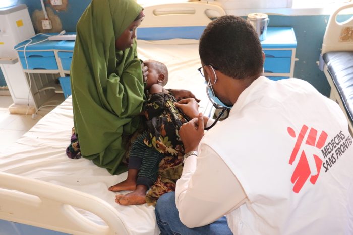 Paciente atendida por desnutrición en el hospital de Las Anod, Somalia