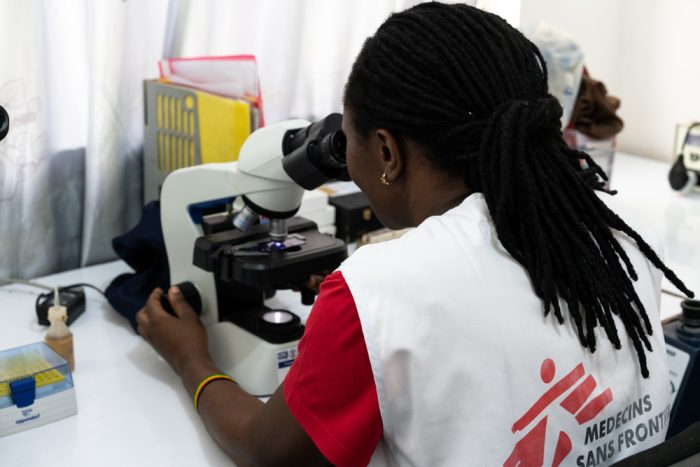 MSF lab manager Mercy Oluya performs a kala azar diagnostic test in the MSF laboratory in Abdurafi.